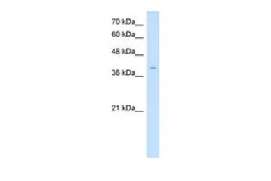 Anti-LSAMP antibody, N-term used in Western Blot (WB). GTX30807