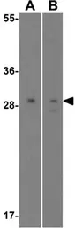 Anti-SLUG antibody used in Western Blot (WB). GTX30813