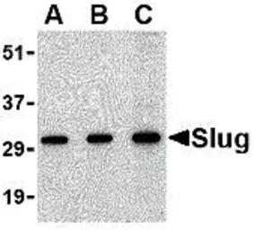 Anti-SLUG antibody used in Western Blot (WB). GTX30813