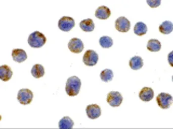 Anti-LAMP2 antibody used in Immunocytochemistry/ Immunofluorescence (ICC/IF). GTX30881