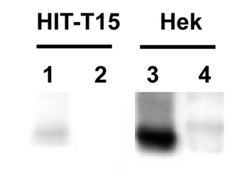Anti-Parkin antibody used in Western Blot (WB). GTX30969