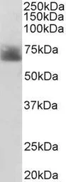 Anti-Serotonin Transporter antibody, Internal used in Western Blot (WB). GTX31103