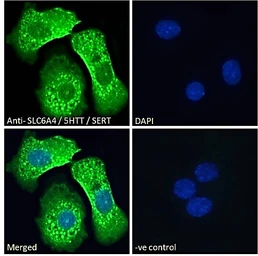 Anti-Serotonin Transporter antibody, Internal used in Immunocytochemistry/ Immunofluorescence (ICC/IF). GTX31103
