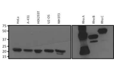 Anti-RhoA + RhoB + RhoC antibody [1A11-4G10] used in Western Blot (WB). GTX31128
