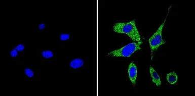 Anti-RhoA + RhoB + RhoC antibody [1A11-4G10] used in Immunocytochemistry/ Immunofluorescence (ICC/IF). GTX31128