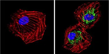 Anti-SOD2 antibody [1H6] used in Immunocytochemistry/ Immunofluorescence (ICC/IF). GTX31147