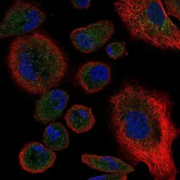Anti-TNF Receptor II antibody used in Immunocytochemistry/ Immunofluorescence (ICC/IF). GTX31250