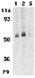 Anti-CCR3 antibody used in Western Blot (WB). GTX31254