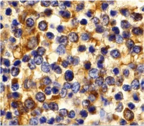 Anti-CCR3 antibody used in IHC (Paraffin sections) (IHC-P). GTX31254