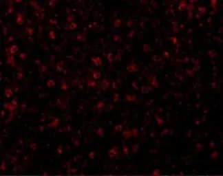 Anti-CCR3 antibody used in IHC (Paraffin sections) (IHC-P). GTX31254