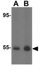 Anti-CX3CR1 antibody used in Western Blot (WB). GTX31260