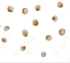 Anti-DFFB antibody used in Immunocytochemistry/ Immunofluorescence (ICC/IF). GTX31262
