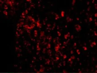 Anti-AVEN antibody used in IHC (Paraffin sections) (IHC-P). GTX31269
