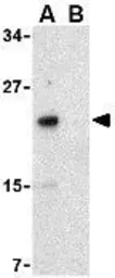 Anti-NKIRAS2 antibody used in Western Blot (WB). GTX31273