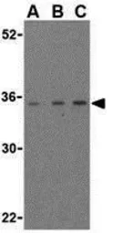 Anti-MAP1 antibody used in Western Blot (WB). GTX31275