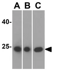 Anti-Caspase 8 antibody used in Western Blot (WB). GTX31284