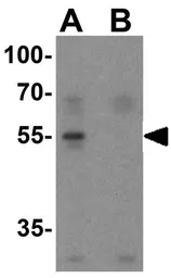 Anti-Caspase 8 antibody used in Western Blot (WB). GTX31284