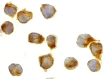 Anti-Caspase 8 antibody used in Immunocytochemistry/ Immunofluorescence (ICC/IF). GTX31284
