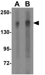 Anti-TSC2 antibody used in Western Blot (WB). GTX31287