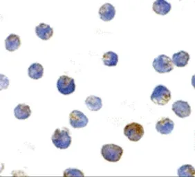 Anti-TSC2 antibody used in Immunocytochemistry/ Immunofluorescence (ICC/IF). GTX31287