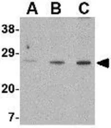 Anti-XBP1 antibody used in Western Blot (WB). GTX31292