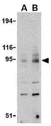 Anti-TLR9 antibody used in Western Blot (WB). GTX31294
