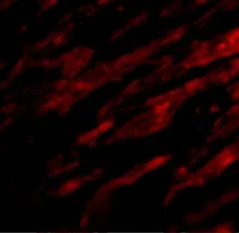 Anti-PD-L1 antibody used in IHC (Paraffin sections) (IHC-P). GTX31308
