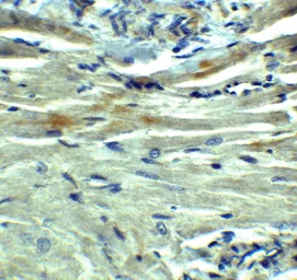 Anti-PD-L1 antibody used in IHC (Paraffin sections) (IHC-P). GTX31308