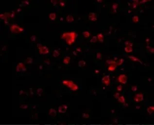 Anti-ARMET antibody used in IHC (Paraffin sections) (IHC-P). GTX31324