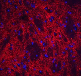 Anti-NP2 antibody used in IHC (Paraffin sections) (IHC-P). GTX31338
