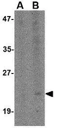 Anti-CD317 antibody used in Western Blot (WB). GTX31346