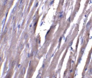 Anti-ASAH1 antibody used in IHC (Paraffin sections) (IHC-P). GTX31356