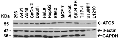 Anti-ATG5 antibody used in Western Blot (WB). GTX31372