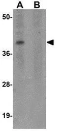 Anti-MC4 Receptor antibody used in Western Blot (WB). GTX31382