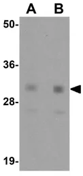 Anti-Nanog antibody used in Western Blot (WB). GTX31400