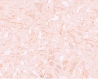Anti-NLRP12 antibody used in IHC (Paraffin sections) (IHC-P). GTX31418