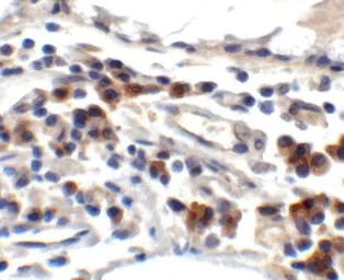 Anti-Trefoil Factor 3 antibody used in IHC (Paraffin sections) (IHC-P). GTX31422