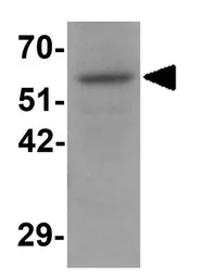 Anti-OGFOD1 antibody used in Western Blot (WB). GTX31426