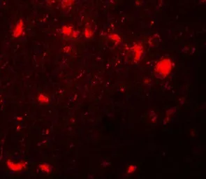 Anti-CBX4 antibody used in IHC (Paraffin sections) (IHC-P). GTX31493