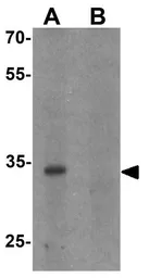 Anti-CBX4 antibody used in Western Blot (WB). GTX31493