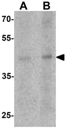 Anti-LMX1A antibody used in Western Blot (WB). GTX31507