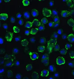 Anti-TYK2 antibody used in Immunocytochemistry/ Immunofluorescence (ICC/IF). GTX31515