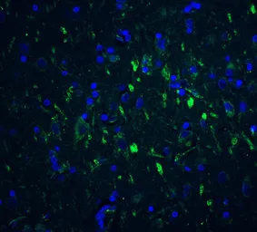 Anti-FOXP3 antibody used in IHC (Paraffin sections) (IHC-P). GTX31517