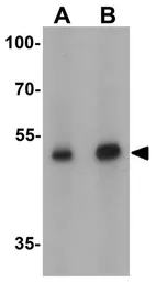 Anti-FOXP3 antibody used in Western Blot (WB). GTX31517