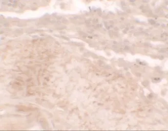 Anti-TLX3 antibody used in IHC (Paraffin sections) (IHC-P). GTX31542