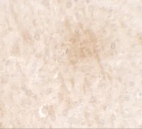 Anti-FGFR3 antibody used in IHC (Paraffin sections) (IHC-P). GTX31549