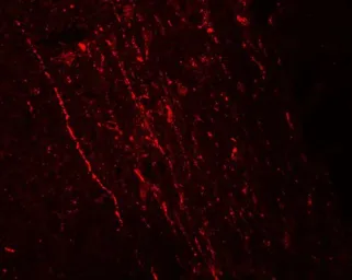 Anti-FGFR3 antibody used in IHC (Paraffin sections) (IHC-P). GTX31549