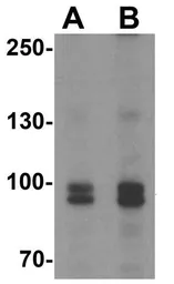 Anti-FGFR3 antibody used in Western Blot (WB). GTX31549