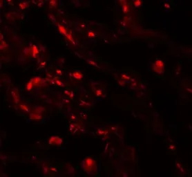 Anti-CD66e antibody used in IHC (Paraffin sections) (IHC-P). GTX31551