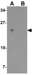 Anti-Mist1 antibody used in Western Blot (WB). GTX31558
